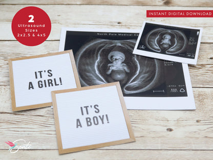 Christmas Elf Ultrasound